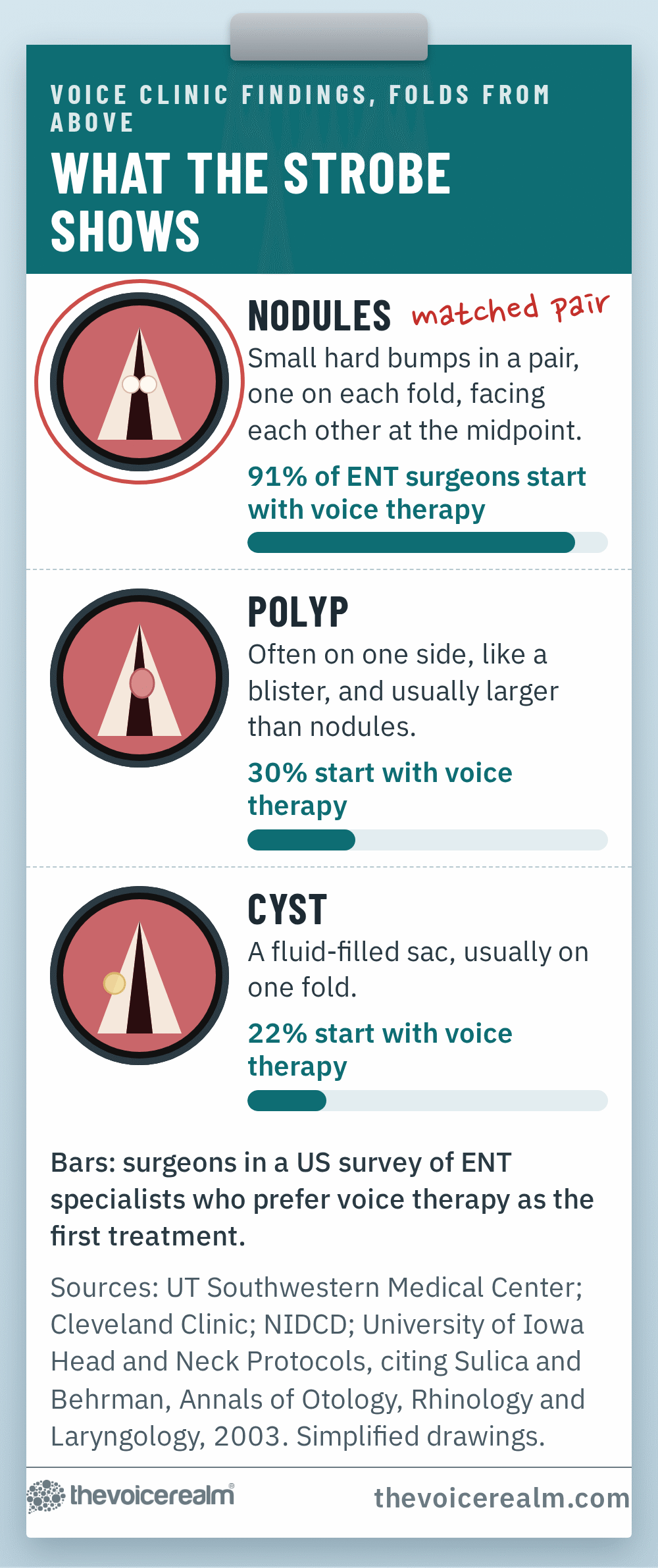 Graphic: a voice clinic findings sheet with simple drawings of the vocal folds from above showing paired nodules, a one sided polyp and a cyst, with the share of surgeons in a US survey of ENT specialists who prefer voice therapy first: 91% for nodules, 30% for polyps, 22% for cysts © The Voice Realm